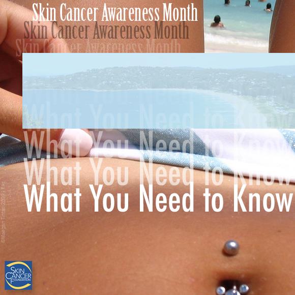 Skin Cancer Awareness Month: What You Need to Know
